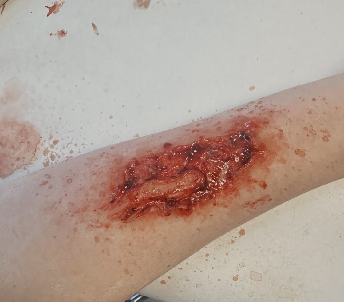 4 Inch Cut #2 prosthetic applied and painted