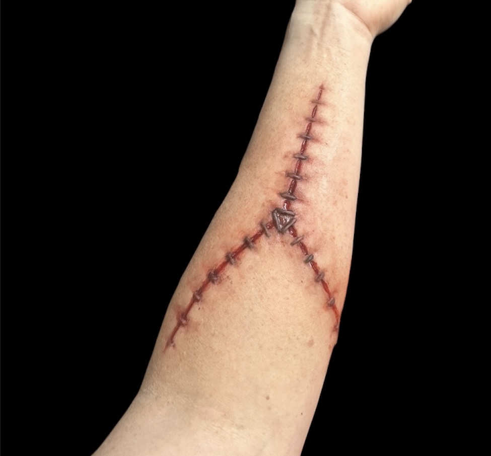 Y Incision with Stitches prosthetic applied and painted